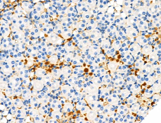 Phospho-TSC2 (Ser1254) Antibody in Immunohistochemistry (Paraffin) (IHC (P))