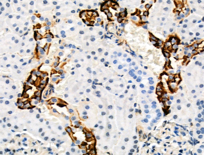 Phospho-TSC2 (Ser1254) Antibody in Immunohistochemistry (Paraffin) (IHC (P))