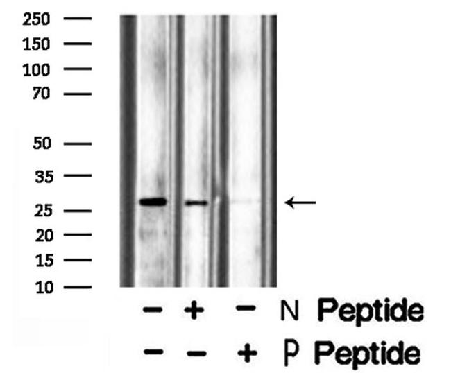 Phospho-Aquaporin 2 (Ser261) Antibody in Western Blot (WB)