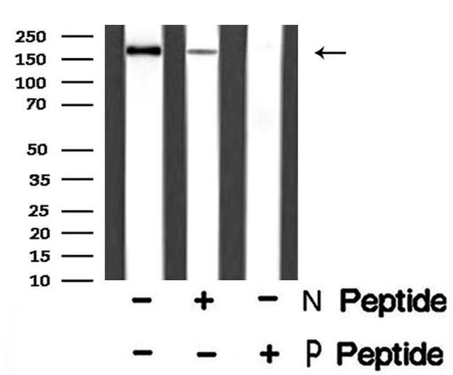 Phospho-ErbB4 (Tyr1056) Antibody in Western Blot (WB)