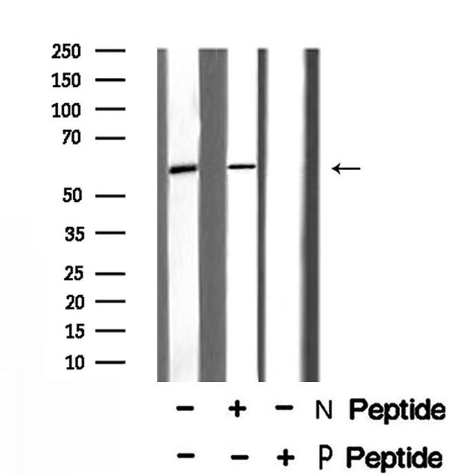 Phospho-IRF5 (Ser437) Antibody in Western Blot (WB)