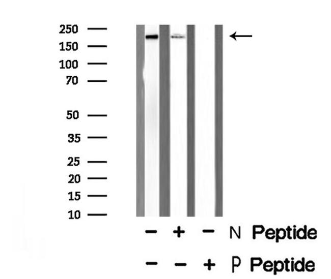 Phospho-MYLK (Tyr464) Antibody in Western Blot (WB)