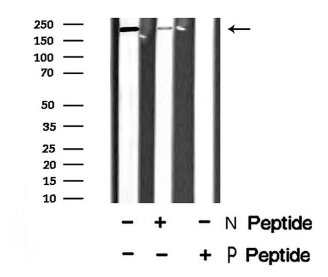 Phospho-MYLK (Tyr471) Antibody in Western Blot (WB)