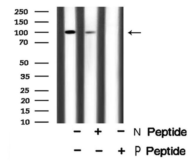 Phospho-ROR1 (Tyr786) Antibody in Western Blot (WB)