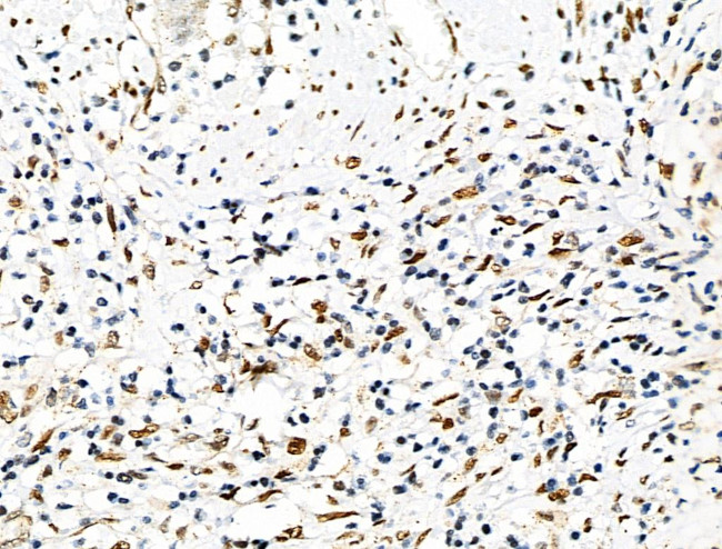 Phospho-eIF2 beta (Ser2) Antibody in Immunohistochemistry (Paraffin) (IHC (P))