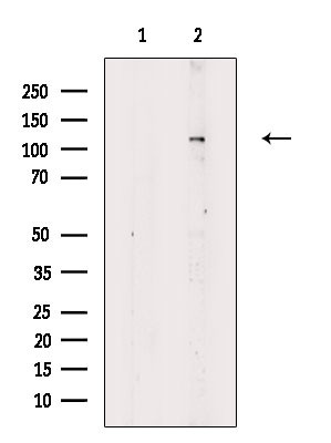 Phospho-HSPH1 (Ser809) Antibody in Western Blot (WB)