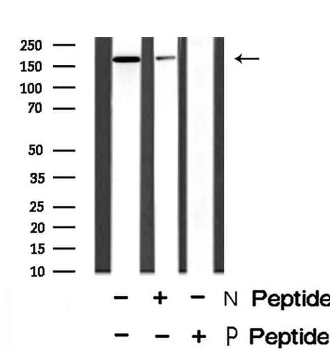 Phospho-SRC3 (Ser857) Antibody in Western Blot (WB)