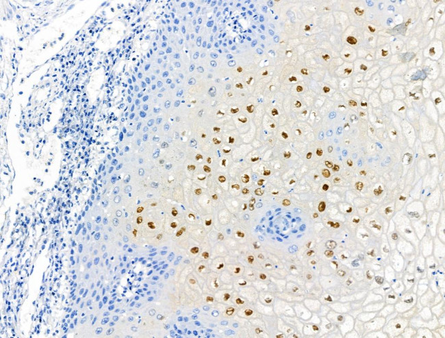 Phospho-NPM1 (Thr237) Antibody in Immunohistochemistry (Paraffin) (IHC (P))