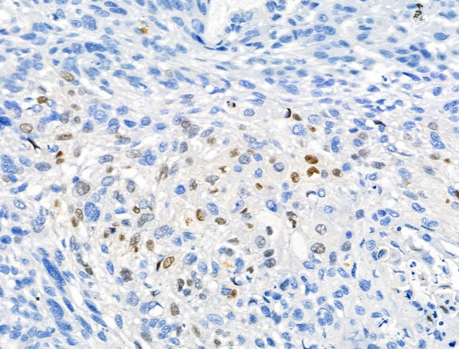 Phospho-NPM1 (Thr237) Antibody in Immunohistochemistry (Paraffin) (IHC (P))