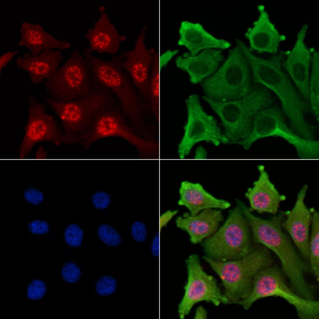 Phospho-Trf2 (Ser365) Antibody in Immunocytochemistry (ICC/IF)