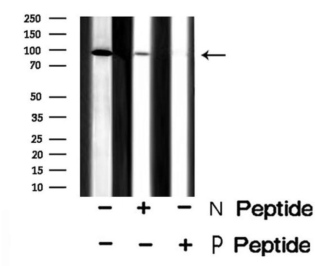 Phospho-TRPV1 (Ser502) Antibody in Western Blot (WB)