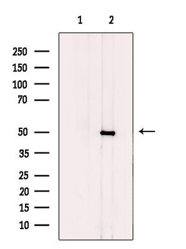 CtBP1/CtBP2 Antibody in Western Blot (WB)