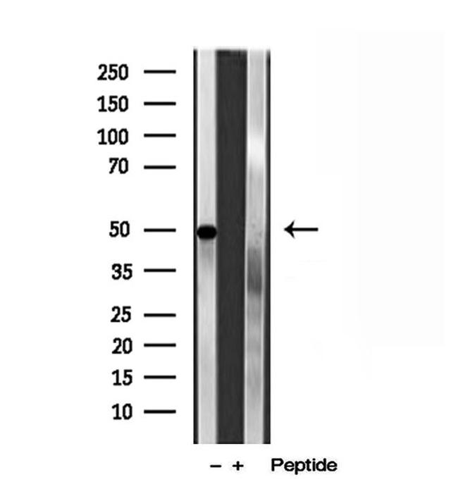 PADI2 Antibody in Western Blot (WB)