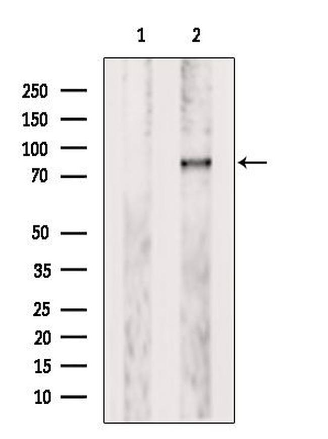 PLOD3 Antibody in Western Blot (WB)