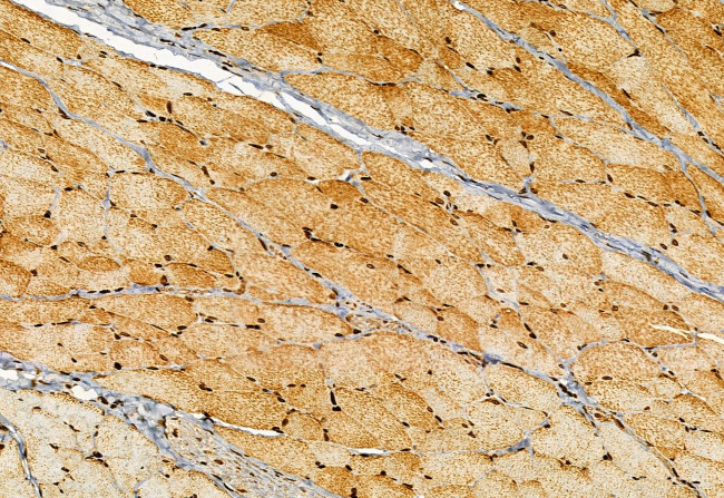 CISD1 Antibody in Immunohistochemistry (Paraffin) (IHC (P))