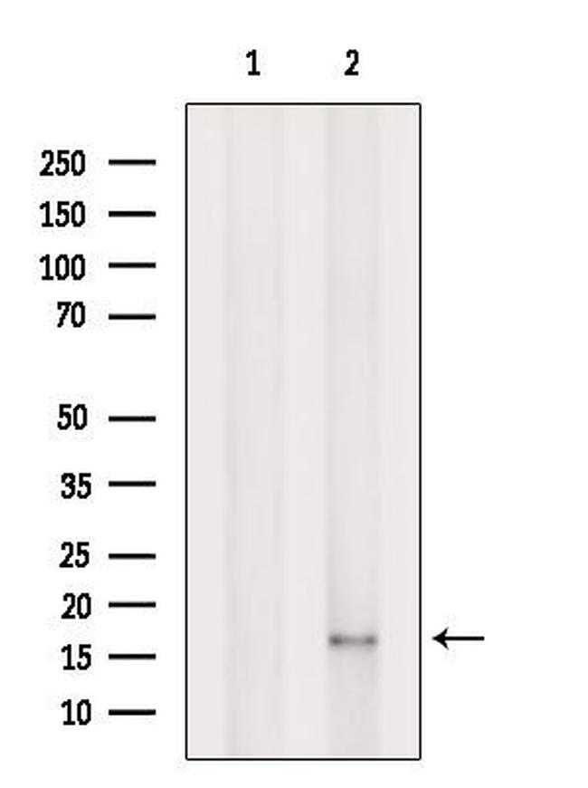 CISD1 Antibody in Western Blot (WB)