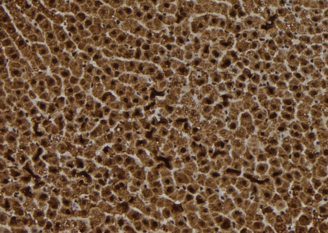 S100A14 Antibody in Immunohistochemistry (Paraffin) (IHC (P))