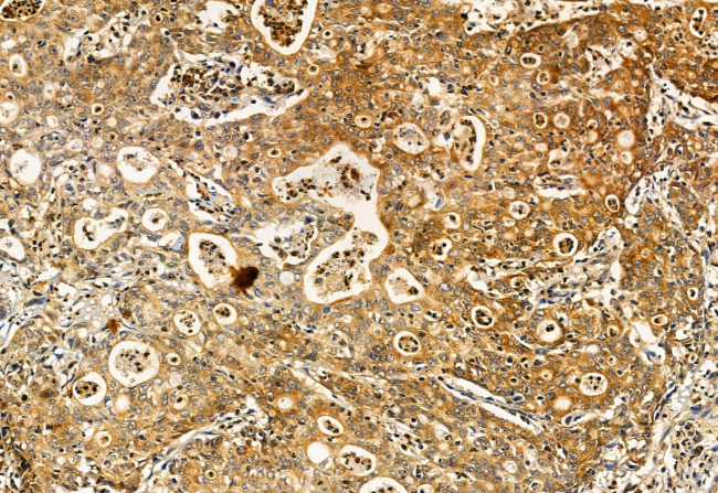 S100A14 Antibody in Immunohistochemistry (Paraffin) (IHC (P))