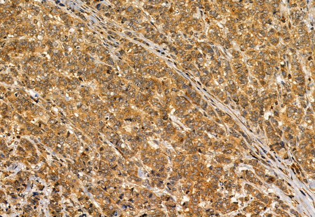 S100A14 Antibody in Immunohistochemistry (Paraffin) (IHC (P))