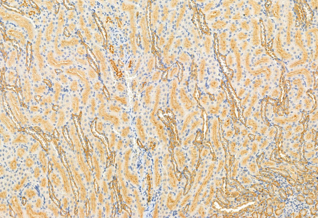 DHRS3 Antibody in Immunohistochemistry (Paraffin) (IHC (P))