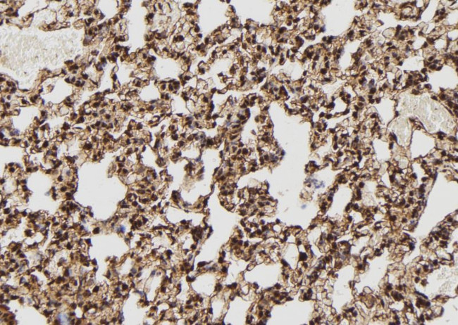 DSS1 Polyclonal Antibody (PA5-106312)