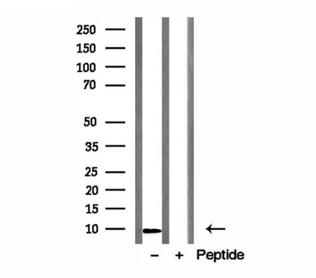 DSS1 Polyclonal Antibody (PA5-106312)