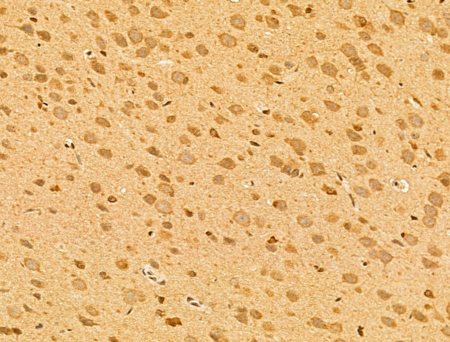 SYNPO2 Antibody in Immunohistochemistry (Paraffin) (IHC (P))