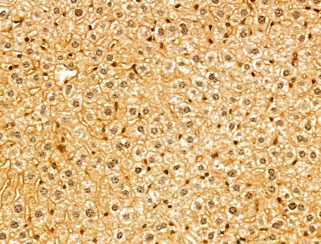 SYNPO2 Antibody in Immunohistochemistry (Paraffin) (IHC (P))