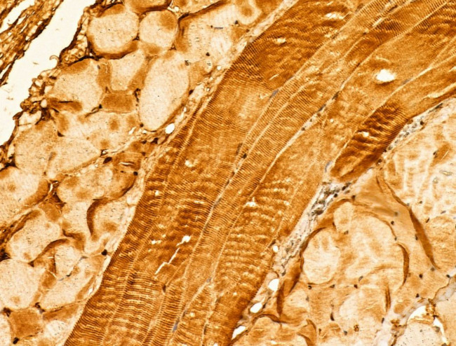 SYNPO2 Antibody in Immunohistochemistry (Paraffin) (IHC (P))