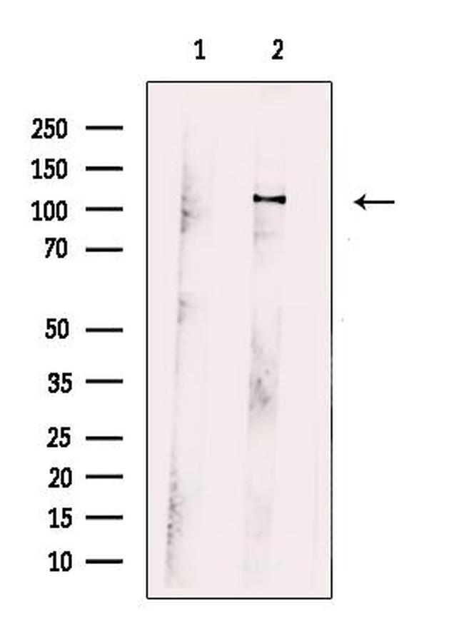 SYNPO2 Antibody in Western Blot (WB)