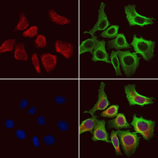 ACADVL Antibody in Immunocytochemistry (ICC/IF)