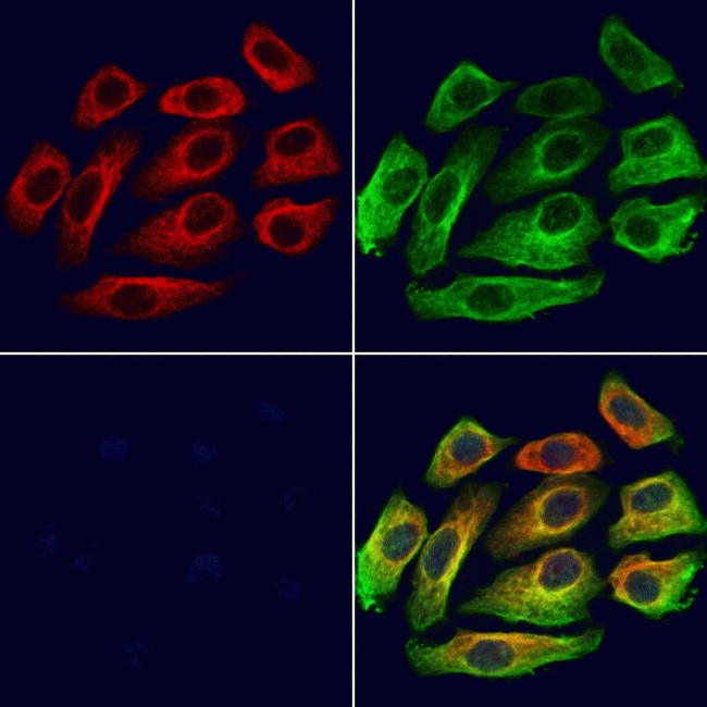 KIFC3 Antibody in Immunocytochemistry (ICC/IF)