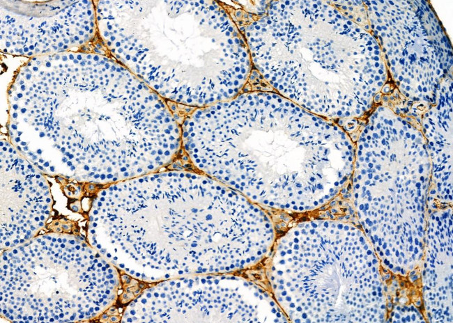 KIFC3 Antibody in Immunohistochemistry (Paraffin) (IHC (P))