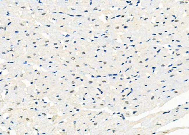 NDUFS7 Antibody in Immunohistochemistry (Paraffin) (IHC (P))