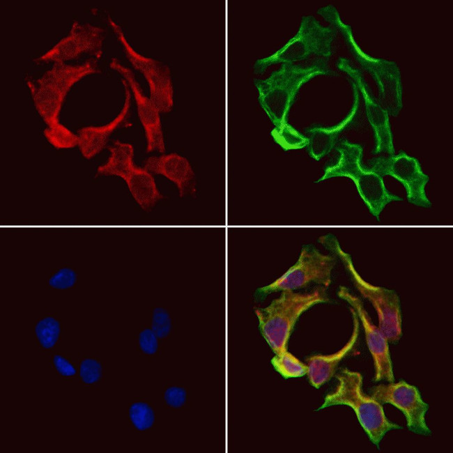 SLC38A3 Antibody in Immunocytochemistry (ICC/IF)