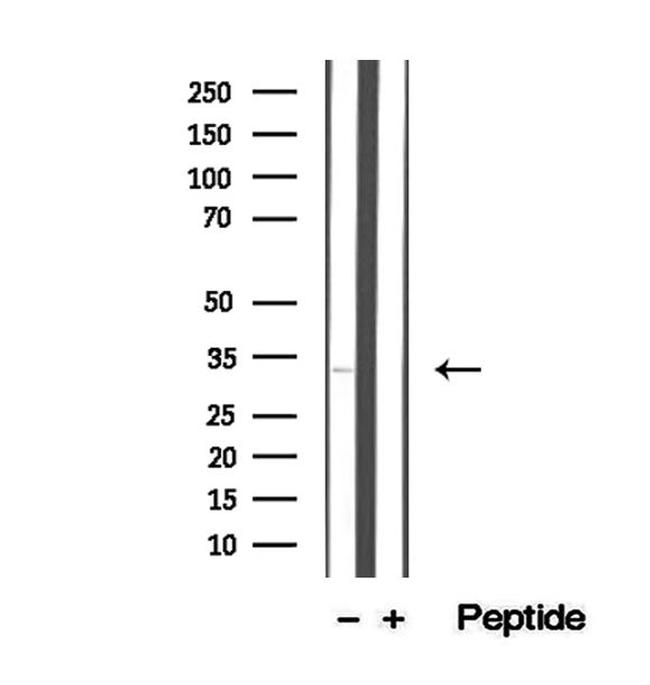 STC2 Antibody in Western Blot (WB)