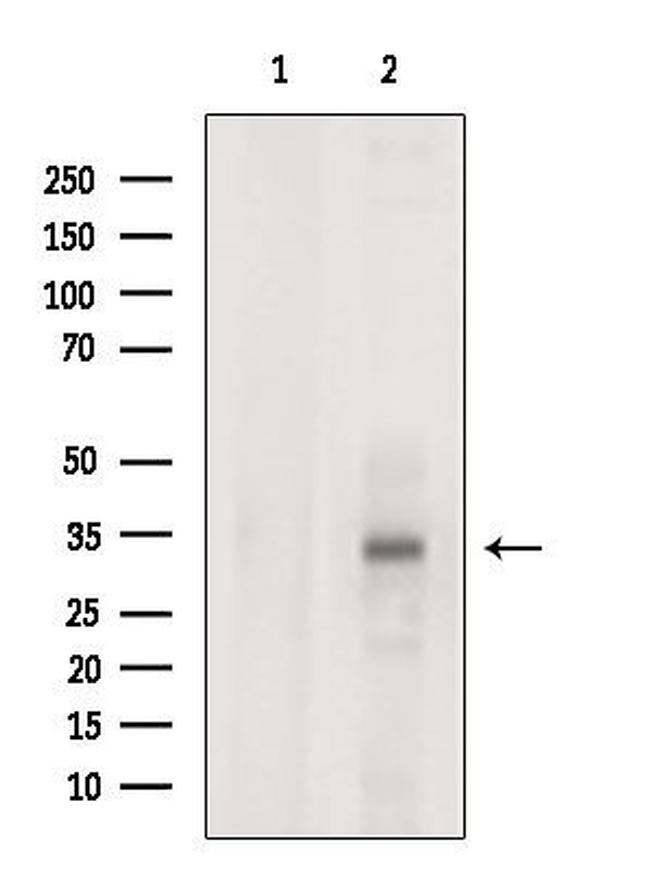STC2 Antibody in Western Blot (WB)