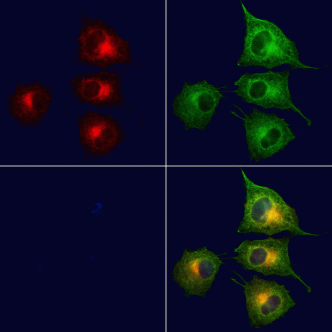 TIMM44 Antibody in Immunocytochemistry (ICC/IF)