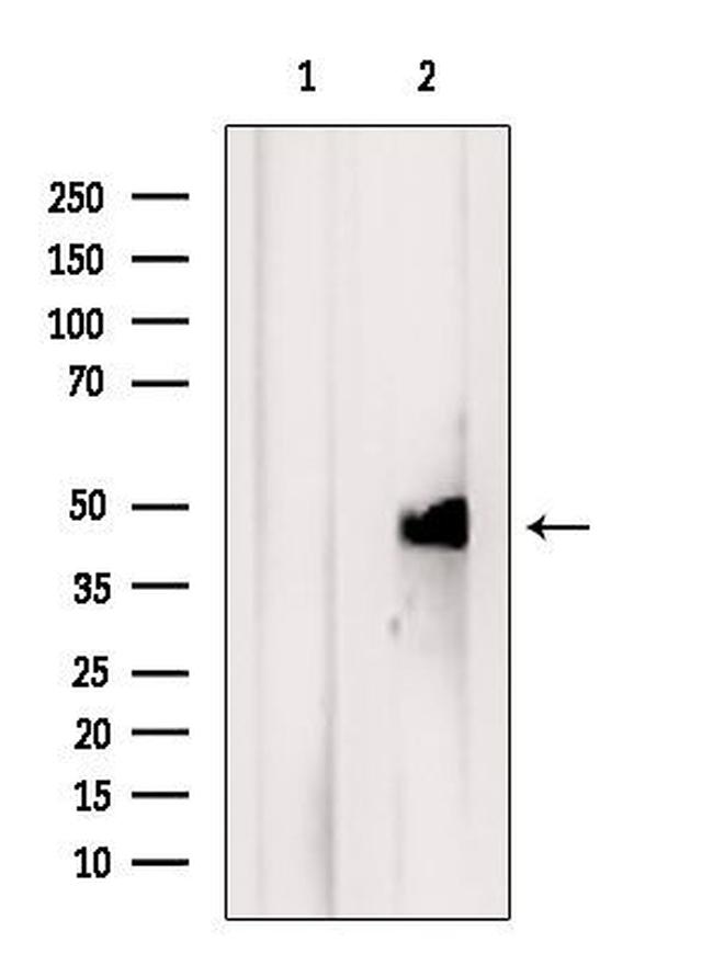 TIMM44 Antibody in Western Blot (WB)