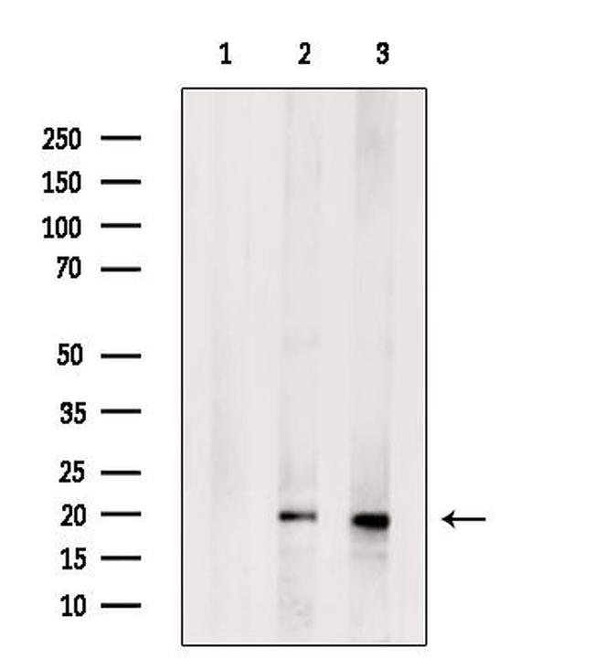 CPLX2 Antibody in Western Blot (WB)