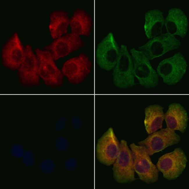 DCTN6 Antibody in Immunocytochemistry (ICC/IF)