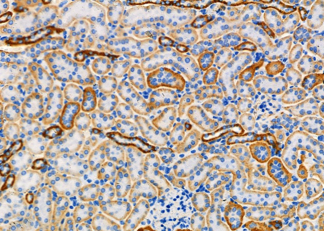 DCTN6 Antibody in Immunohistochemistry (Paraffin) (IHC (P))