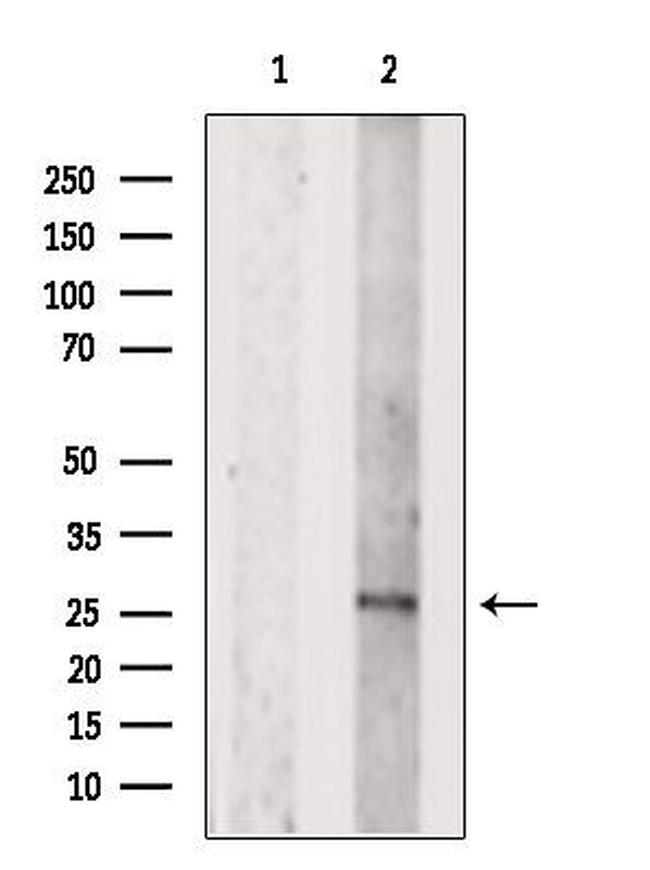 DCTN6 Antibody in Western Blot (WB)