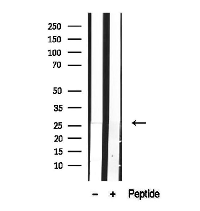 DCTN6 Antibody in Western Blot (WB)