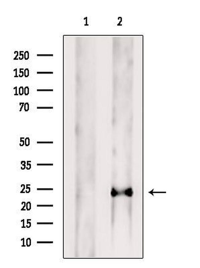 PRL1 Antibody in Western Blot (WB)