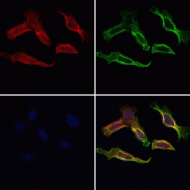 Cyclophilin F Antibody in Immunocytochemistry (ICC/IF)