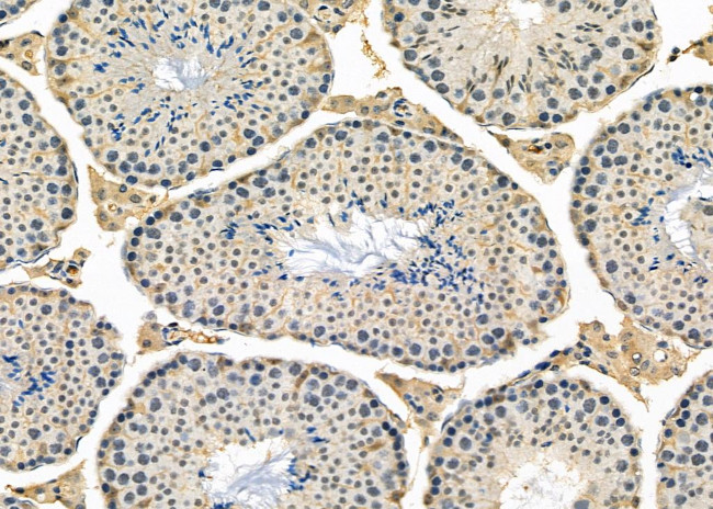 ADCK5 Antibody in Immunohistochemistry (Paraffin) (IHC (P))