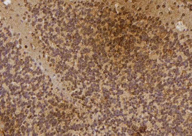 IP6K3 Antibody in Immunohistochemistry (Paraffin) (IHC (P))