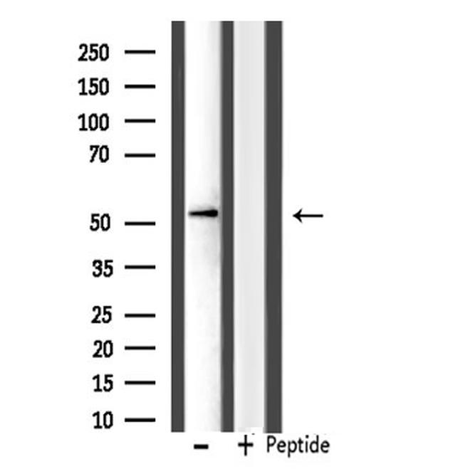 IP6K3 Antibody in Western Blot (WB)