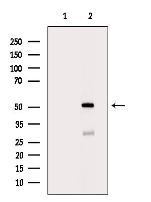 IP6K3 Antibody in Western Blot (WB)